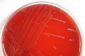 Mitä Enterococcus faecalis tarkoittaa miehen kokeessa?